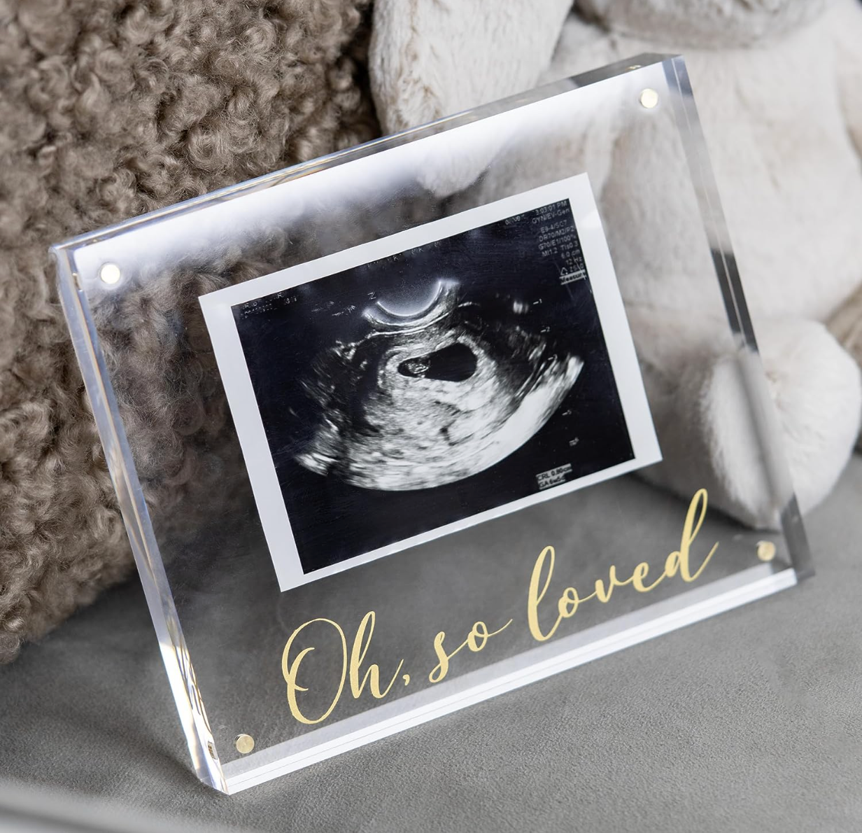 Ultrasound Picture Frames MAMA loves MINI